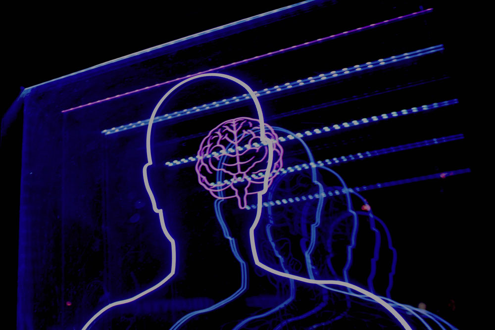 neurofeedback